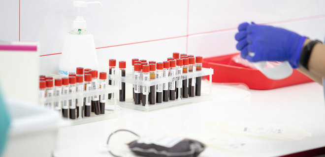 Центр крові безоплатно тестуватиме на антитіла до COVID-19 кров донорів - Фото