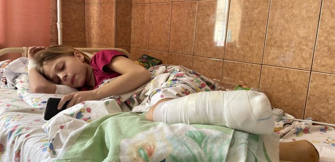 Щодня в Україні гине двоє дітей і четверо отримують поранення через вибухи – ООН - Фото