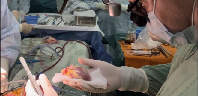 В Україні вперше виконали трансплантацію серця 6-річній дитині - Фото
