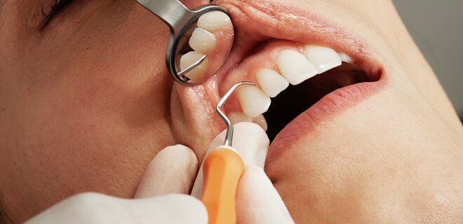 Плохое здоровье зубов связывают со снижением умственных способностей — исследование - Фото
